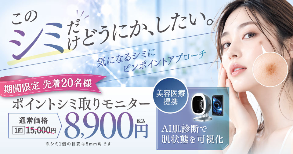ポイントシミ取りモニター　1回8,900円（税込）