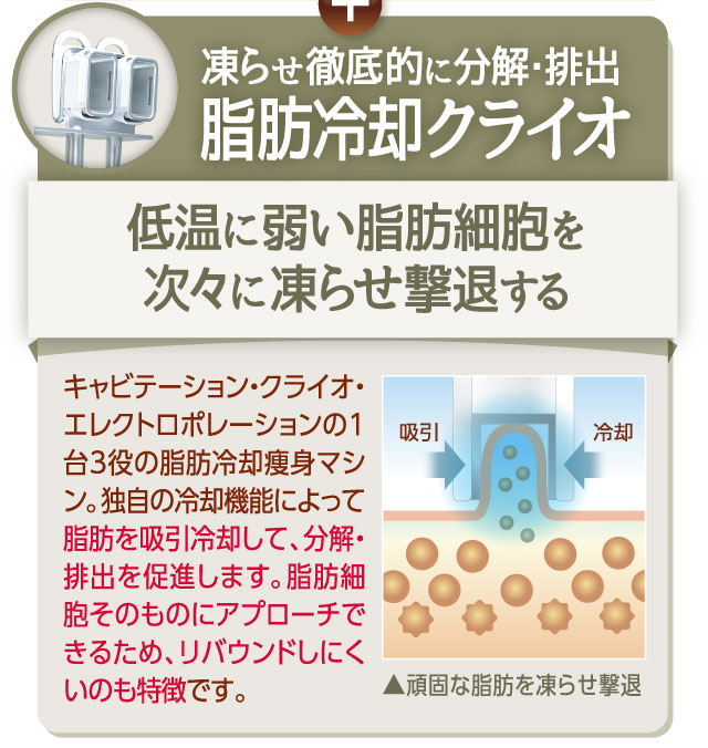 凍らせ徹底的に分解と排出　脂肪冷却クライオ