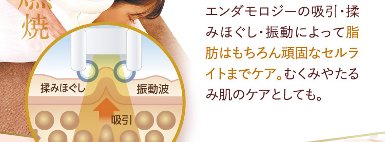 エンダモロジーの吸引・揉みほぐし・振動（揉みほぐし, 振動波, 吸引）によって脂肪はもちろん頑固なセルライトまでケア。むくみやたるみ肌のケアとしても。