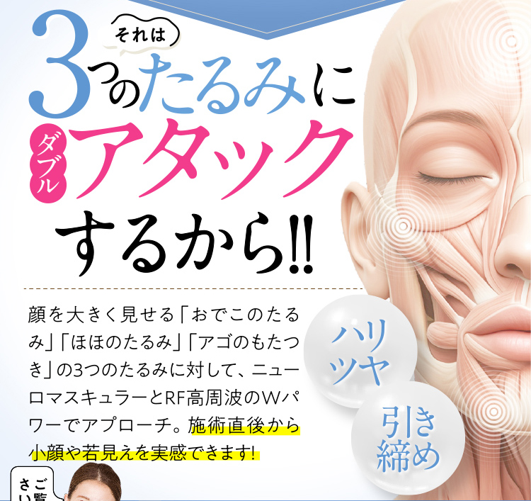 それは3つのたるみにダブルアタックするから！！
