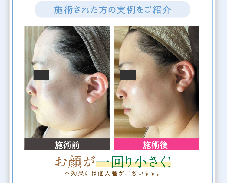 施術された方の実例1