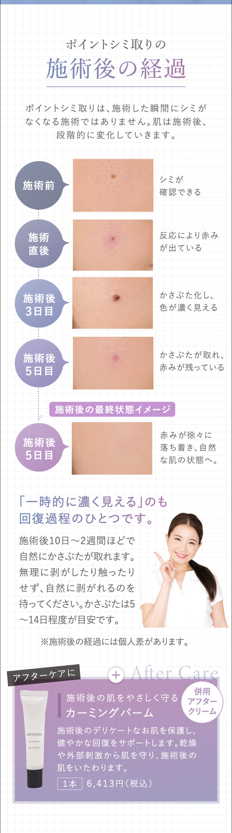 ポイントシミ取りの施術後の経過