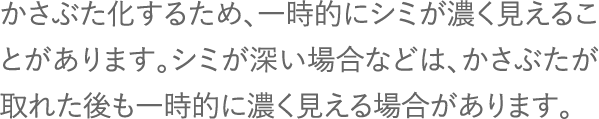 かさぶた化するため、一時的にシミが濃く見えることがあります。シミが深い場合などは、かさぶたが取れた後も一時的に濃く見える場合があります。