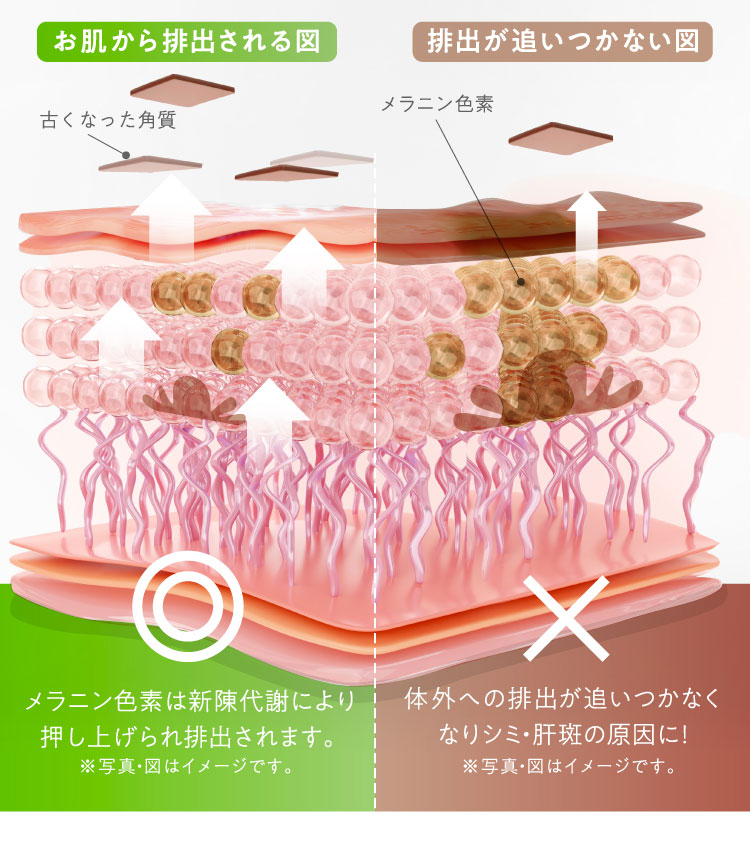 お肌から排出される図：メラニン色素は新陳代謝により押し上げられ排出されます。 排出が追いつかない図：体外への排出が追いつかなくなりシミ・肝斑の原因に！