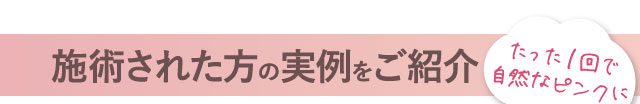 施術された方の実例をご紹介