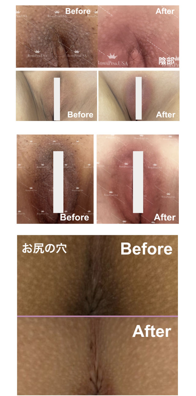 結果写真
