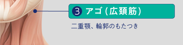 3アゴ(広頚筋)二重顎、輪郭のもたつき