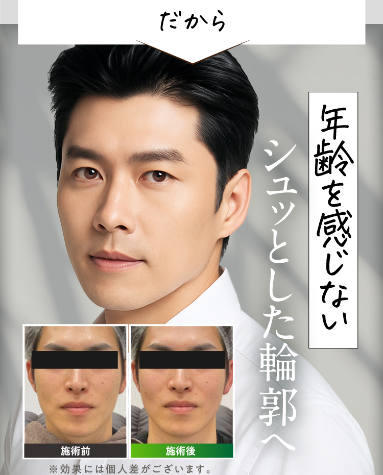だから年齢を感じないシュッとした輪郭へ