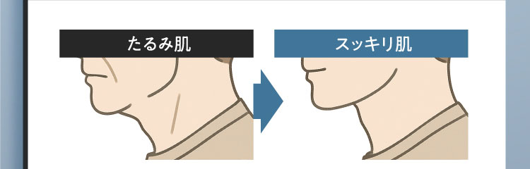 たるみ肌 スッキリ肌
