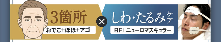 3箇所おでこ+ほほ+アゴ × しわ・たるみケア RF+ニューロマスキュラー