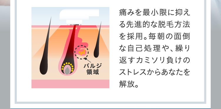 痛みを最小限に抑える先進的な脱毛方法を採用。毎朝の面倒な自己処理や、繰り返すカミソリ負けのストレスからあなたを解放。